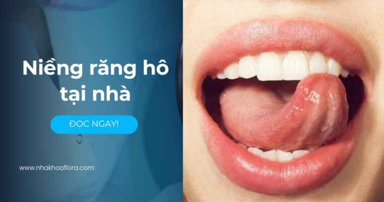 niềng răng hô tại nhà