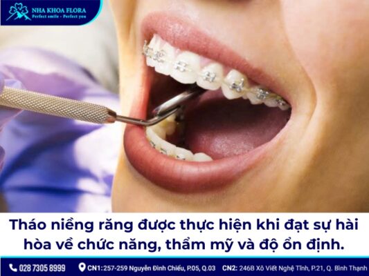 tháo niềng răng - ảnh 2