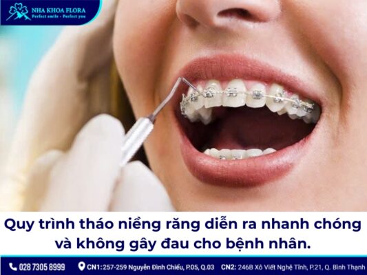 tháo niềng răng - ảnh 3