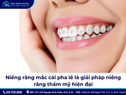 niềng răng mắc cài pha lê - ảnh 1