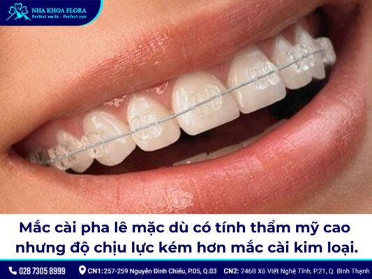 niềng răng mắc cài pha lê - ảnh 2