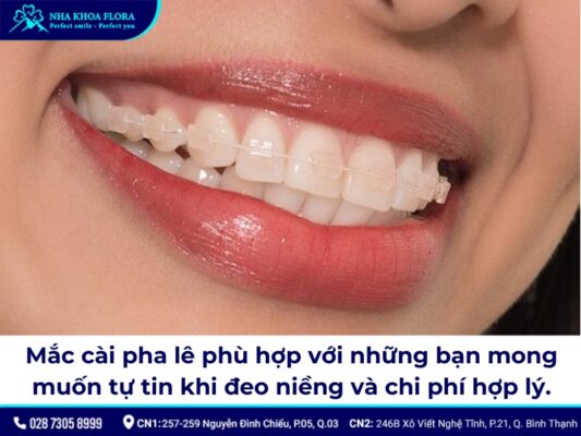 niềng răng mắc cài pha lê - ảnh 3