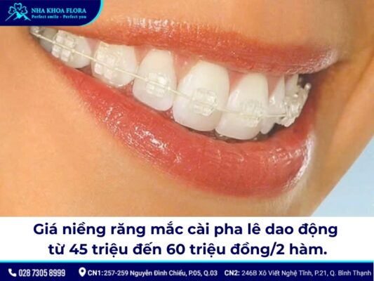 niềng răng mắc cài pha lê - ảnh 4